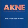 Akne – Pathophysiologie-Klinik-Diagnose&Therapie