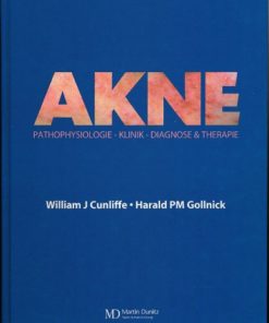 Akne – Pathophysiologie-Klinik-Diagnose&Therapie