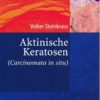 Aktinische Keratosen (Carcinomata in situ)