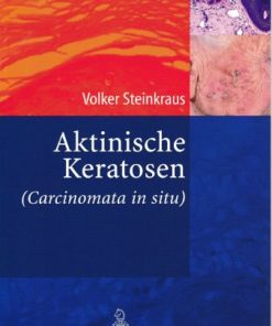 Aktinische Keratosen (Carcinomata in situ)