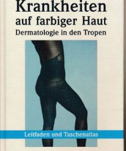 Krankheiten auf farbiger Haut – Dermatologie in den Tropen