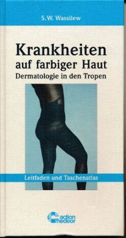 Krankheiten auf farbiger Haut – Dermatologie in den Tropen
