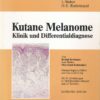 Kutane Melanome – Klinik und Differentialdiagnose