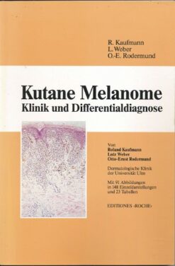 Kutane Melanome – Klinik und Differentialdiagnose