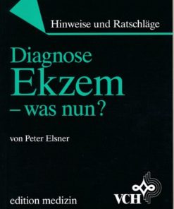 Diagnose Ekzem – was nun?
