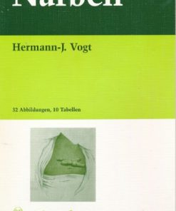 Narben