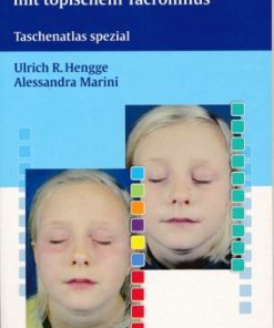 Spezielle Behandlungsoptionen mit topischem Tacrolimus