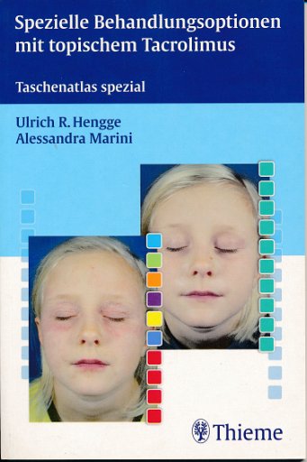 Spezielle Behandlungsoptionen mit topischem Tacrolimus