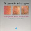 Ekzemerkrankungen