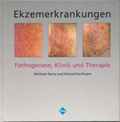 Ekzemerkrankungen