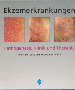 Ekzemerkrankungen