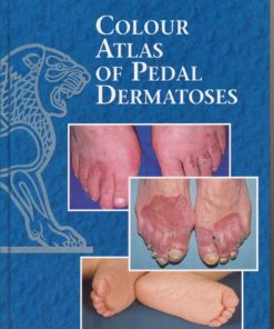 Colour Atlas Of Pedal Dermatoses