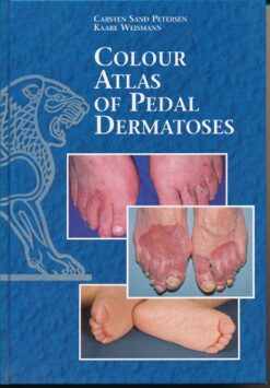 Colour Atlas Of Pedal Dermatoses