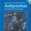 Adipositas – Ursachen und Therapie